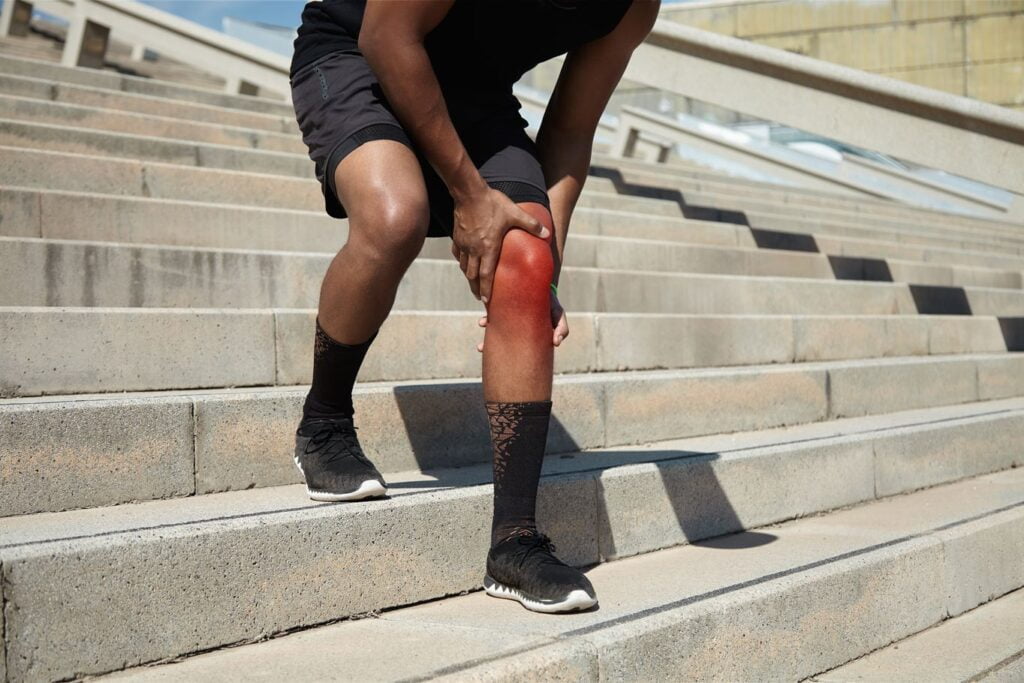 Dor de artrite de joelhos com vermelhidão local, descendo as escadas.